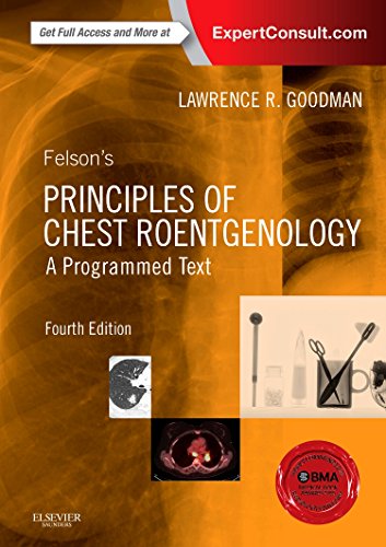 Felson’s Principles of Chest Roentgenology (4th Edition) – eBook