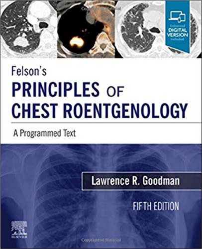 Felson’s Principles of Chest Roentgenology (5th Edition) – eBook