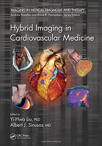 Hybrid Imaging in Cardiovascular Medicine – Imaging in Medical Diagnosis and Therapy – eBook