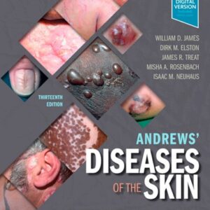 Andrews’ Diseases of the Skin: Clinical Dermatology (13th Edition) – eBook