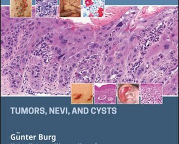 Atlas of Dermatopathology: Tumors, Nevi, and Cysts – PDF