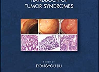 Handbook of Tumor Syndromes – PDF