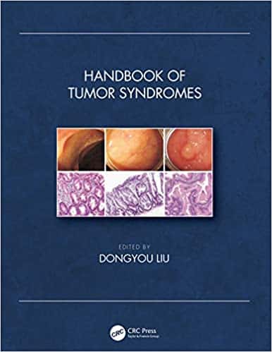 Handbook of Tumor Syndromes – eBook