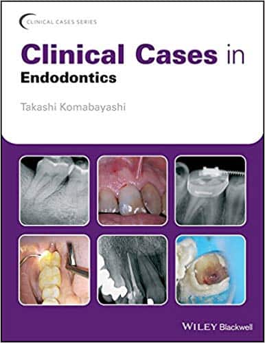Clinical Cases in Endodontics – eBook PDF