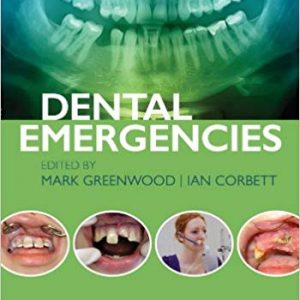 Dental Emergencies – eBook PDF