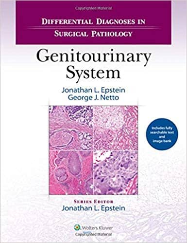 Differential Diagnoses in Surgical Pathology: Genitourinary System – eBook PDF