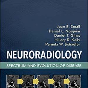 Neuroradiology: Spectrum and Evolution of Disease – PDF