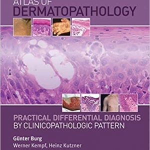 Atlas of Dermatopathology: Practical Differential Diagnosis by Clinicopathologic Pattern – PDF