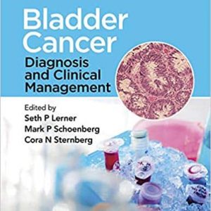 Bladder Cancer: Diagnosis and Clinical Management – PDF