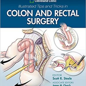 Cleveland Clinic Illustrated Tips and Tricks in Colon and Rectal Surgery – PDF