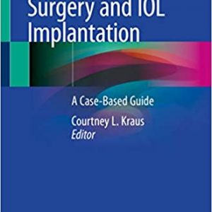 Pediatric Cataract Surgery and IOL Implantation: A Case-Based Guide – PDF
