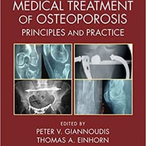 Surgical and Medical Treatment of Osteoporosis: Principles and Practice – PDF