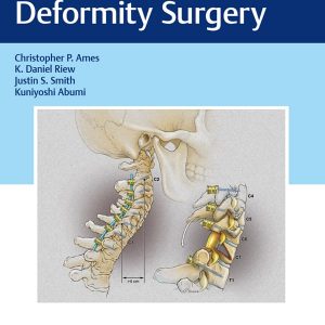 Cervical Spine Deformity Surgery – PDF