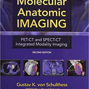 Molecular Anatomic Imaging: PET-CT and SPECT-CT Integrated Modality Imaging (2nd Edition) – eBook PDF