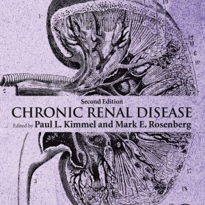 Chronic Renal Disease (2nd Edition) – PDF