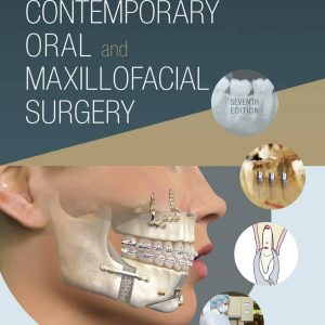 Contemporary Oral and Maxillofacial Surgery (7th Edition) – PDF
