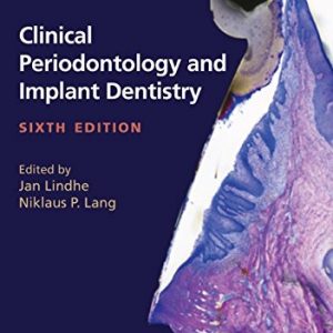 Clinical Periodontology and Implant Dentistry, 2 Volume Set (6th edition) – PDF
