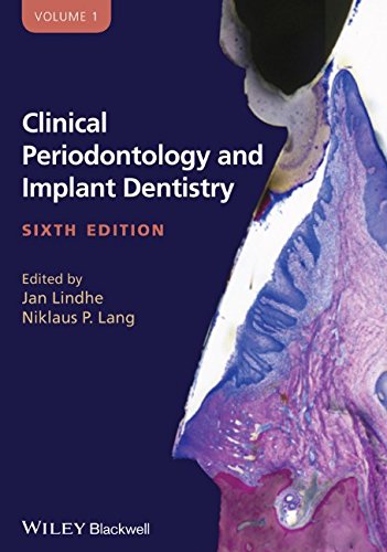 Clinical Periodontology and Implant Dentistry, 2 Volume Set (6th edition) – eBook PDF