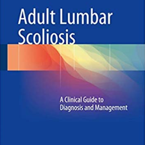 Adult Lumbar Scoliosis: A Clinical Guide to Diagnosis and Management, ISBN-13: 978-3319477077