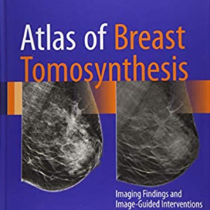 Atlas of Breast Tomosynthesis: Imaging Findings and Image-Guided Interventions, ISBN-13: 978-3319215655