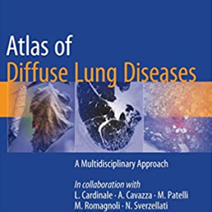Atlas of Diffuse Lung Diseases: A Multidisciplinary Approach, ISBN-13: 978-3319427508