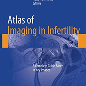 Atlas of Imaging in Infertility: A Complete Guide Based in Key Images, ISBN-13: 978-3319138923