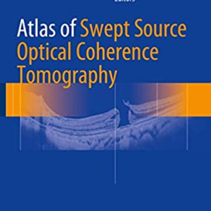 Atlas of Swept Source Optical Coherence Tomography Zofia Michalewska, ISBN-13: 978-3319498393