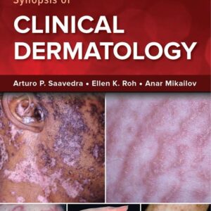 Fitzpatrick's Color Atlas and Synopsis of Clinical Dermatology (9th Edition) – eBook PDF