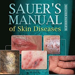 Sauer's Manual of Skin Diseases (11th Edition) – eBook PDF